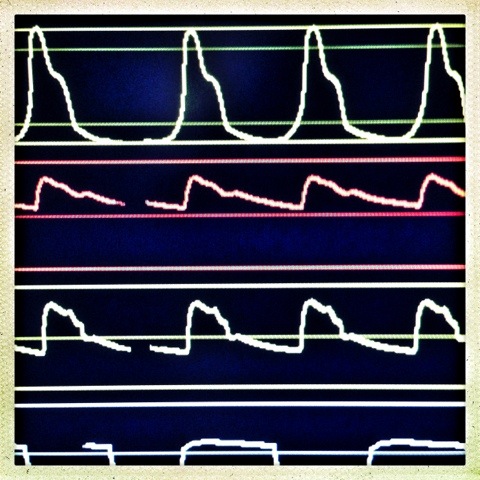 Day 760. vitals